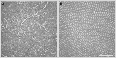 [Micrografías electrónicas de transmisión](https://es.wikipedia.org/wiki/Microscopio_electrónico_de_transmisión) de conjuntos de [colágeno](https://es.wikipedia.org/wiki/Colágeno) de la piel de mandriles coloreada estructuralmente. Fuente: https://journals.biologists.com/jeb/article/207/12/2157/14800/Structural-colouration-of-mammalian-skin.